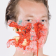 Illustration for article titled Photographs of gruesome injuries made out of cake and ice cream